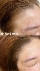 -德绣·机器野生眉发际线·美瞳线半永久