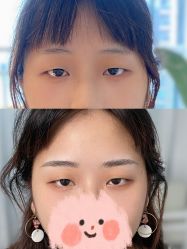 点击看大图 -Doris多里斯半永久纹眉·SMP纹发·发际线