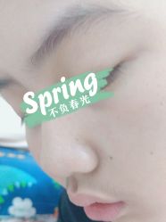 体验后-四川娇点医学美容医院