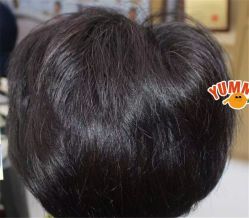 -大麦微针植发全国连锁