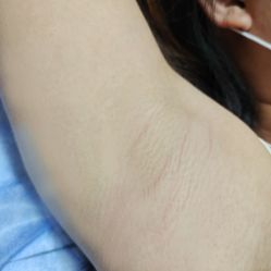 -柠檬一美·Ondapro·轻薄紧致抗衰中心