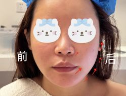 点击看大图 -Yestar 嘉兴艺星医疗美容医院
