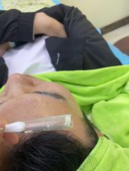 -苗医生0感祛痘连锁