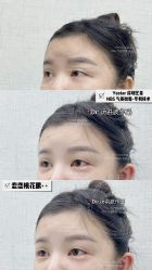 -深圳艺星医疗美容医院