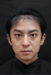 -韩辰医疗美容医院