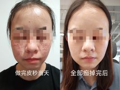 -丽美妍医疗美容·皮秒·立体分层抗衰