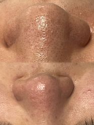 -SKIN79皮肤管理中心