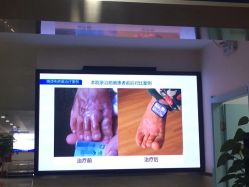 -成都军建医院·疤痕诊疗中心