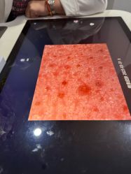 -悟空祛痘·诺奖技术专业店