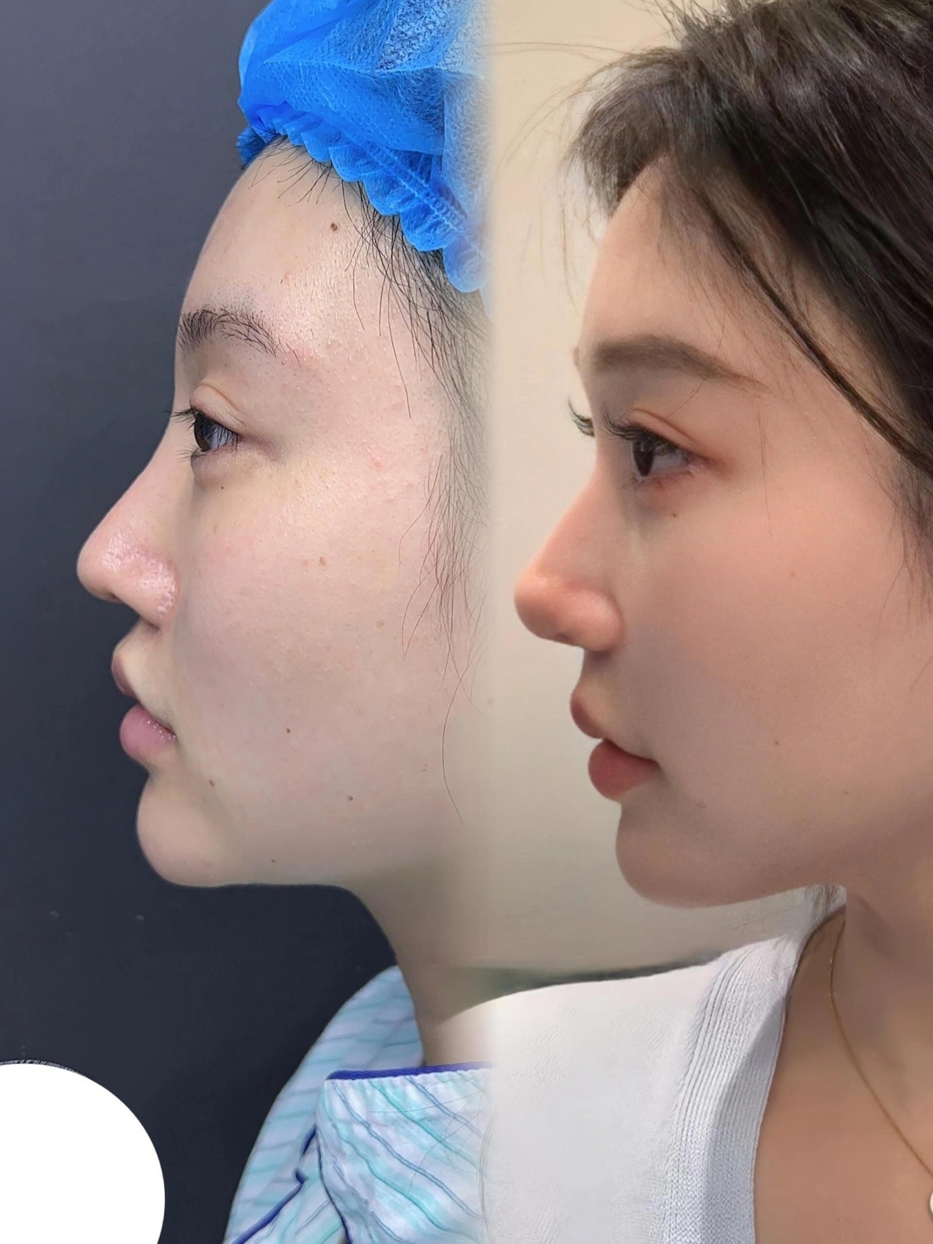 幼态鼻的美感远超乎我的想象!