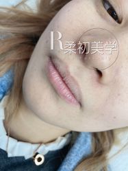 -RC半永久纹眉纹发际线