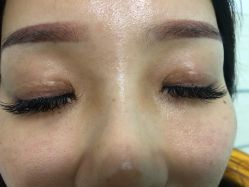 -痣清宫祛斑祛痣连锁店