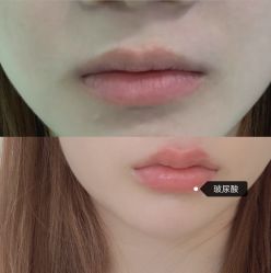 -上海漾颜医疗美容