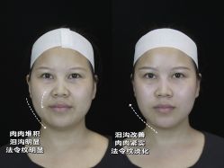 -Yestar重庆艺星医疗美容医院