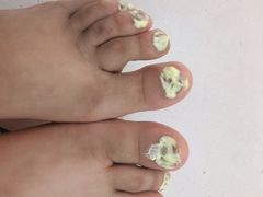 -新甲连锁灰指甲·甲沟炎·鸡眼(黑龙江路店)