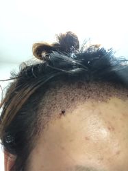 -雍禾植发全国连锁