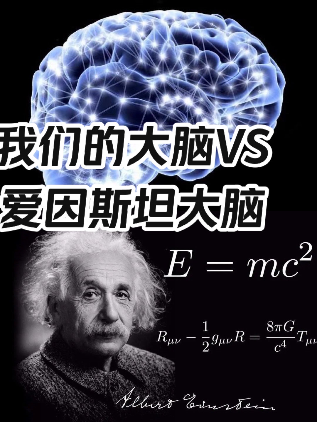 科学家研究发现 \\n爱因斯坦的大脑左右脑08非常协调