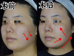 -Yestar重庆艺星医疗美容医院