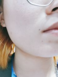 体验后-圣嘉新医疗美容医院