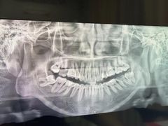 -同步齿科·数字化正畸种植口腔中心(珠海店)