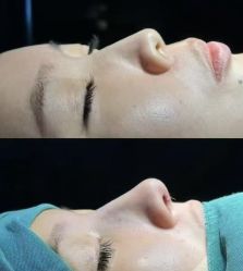 -郡艺医疗美容·微整·眼鼻吸脂