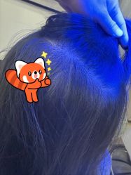 -菩叶脱发白发中心