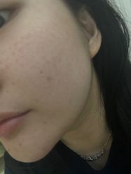 -恒妍医美·韩国定制抗衰中心