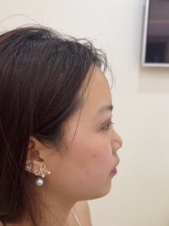 -长沙雅美医疗美容医院