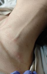 -清疣美疣·痣·斑净肤中心
