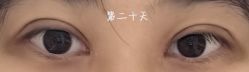 -JustHer宁波珈禾医疗美容医院