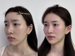 -Yestar重庆艺星医疗美容医院