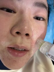 体验前-上海玫瑰医疗美容医院