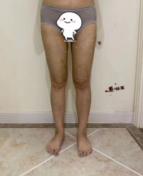 -禾美嘉医疗美容