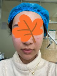 体验前-重庆军科整形美容医院