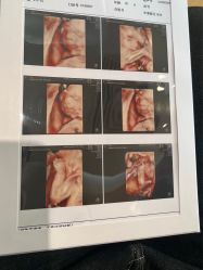 -杭州贝瑞斯美华妇儿医院·早孕·产检·儿科