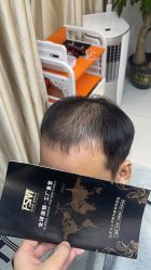 -发饰美男士增发补发假发定制店