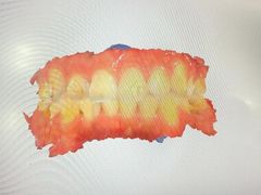-同步齿科·数字化正畸种植口腔中心(珠海店)