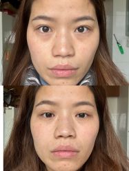 体验前-丽都整形美容医院·全国连锁旗舰店