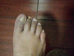 -郑远元专业修脚房(宣化路店)