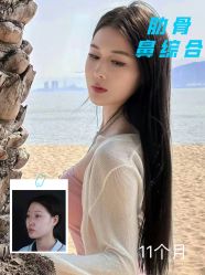 -北京米扬丽格医疗美容·联合丽格鼻整形中心