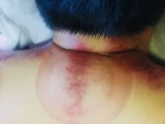 -沈师傅盲人按摩工作室(密三小区店)