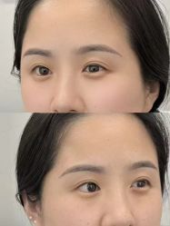 -张小野·专业半永久纹眉