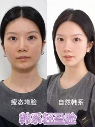 -Yestar重庆艺星医疗美容医院