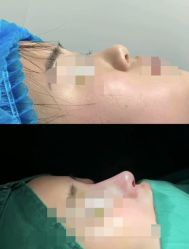 -东莞西妃整形美容医院