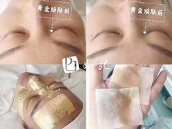 -美肤盾祛痘·问题肌头疗管理中心