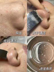 -美愈美肤MEIYU SKIN