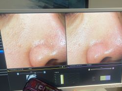 -苑苑vbeauty科技美容SPA