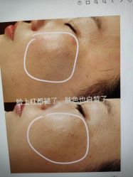 -东森自然美.INDIBA.美容SPA.皮肤管理