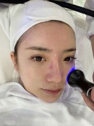 点击看大图 -美肤盾祛痘·问题肌头疗管理中心