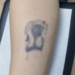 -天道专业洗纹身